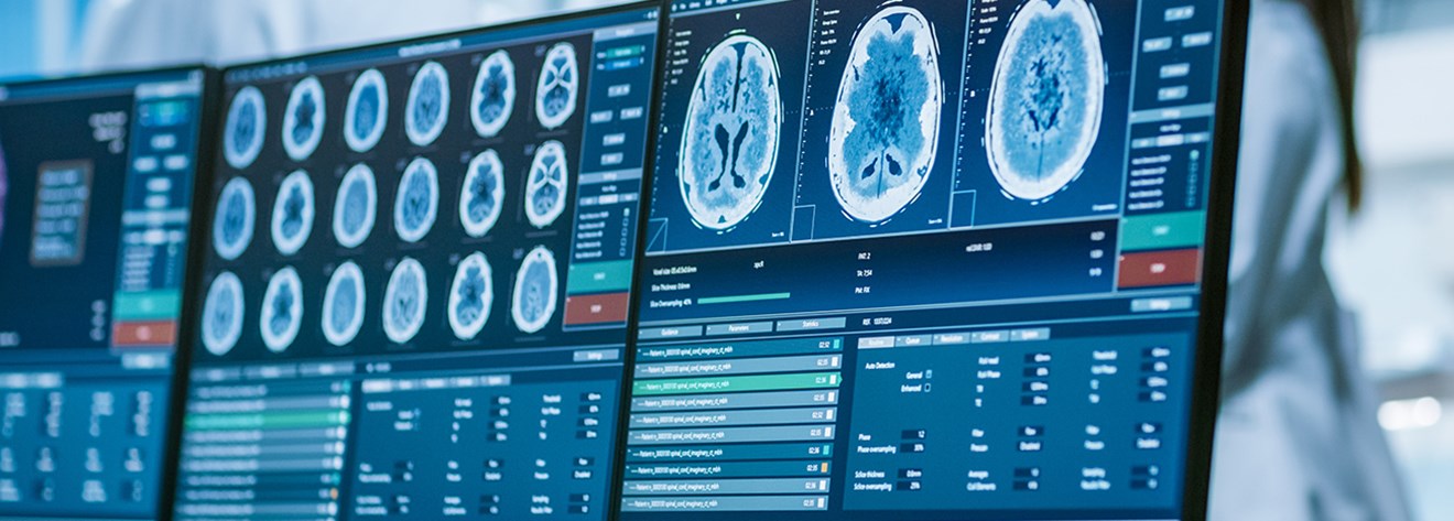 Matrix Scanse Scans | Matrix Neurology